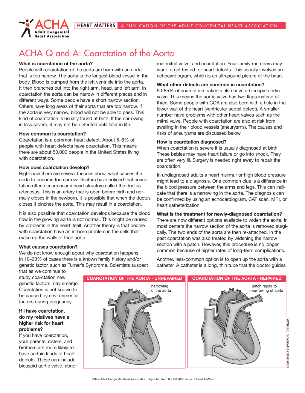 Coarctation of the Aorta What Is Coarctation of the Aorta? Mal Mitral Valve, and Coarctation