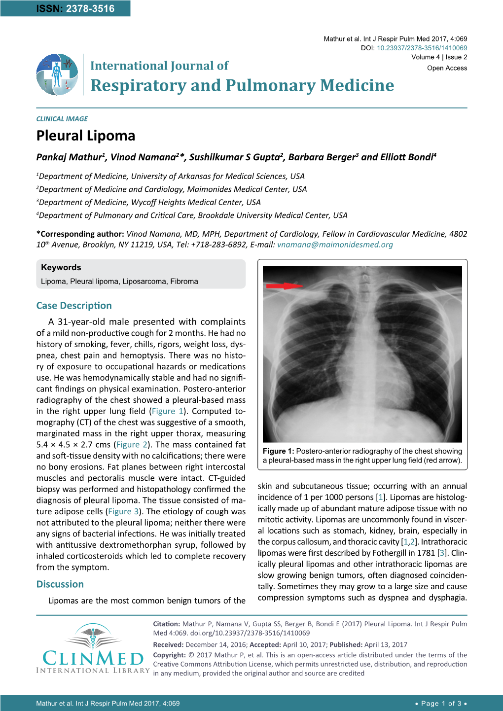 Pleural Lipoma Pankaj Mathur1, Vinod Namana2*, Sushilkumar S Gupta2, Barbara Berger3 and Elliott Bondi4