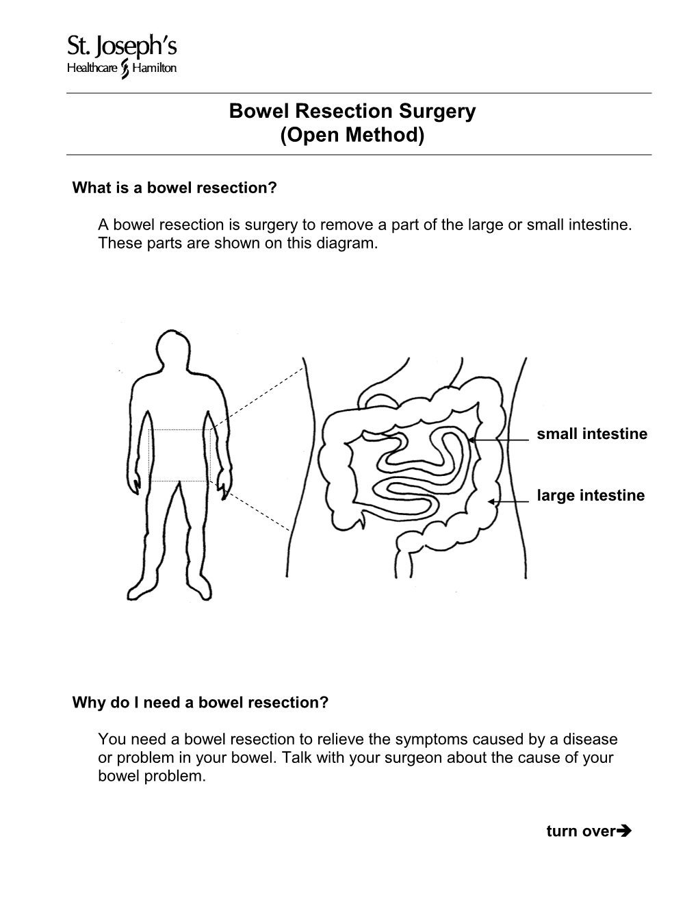 Bowel Resection Surgery