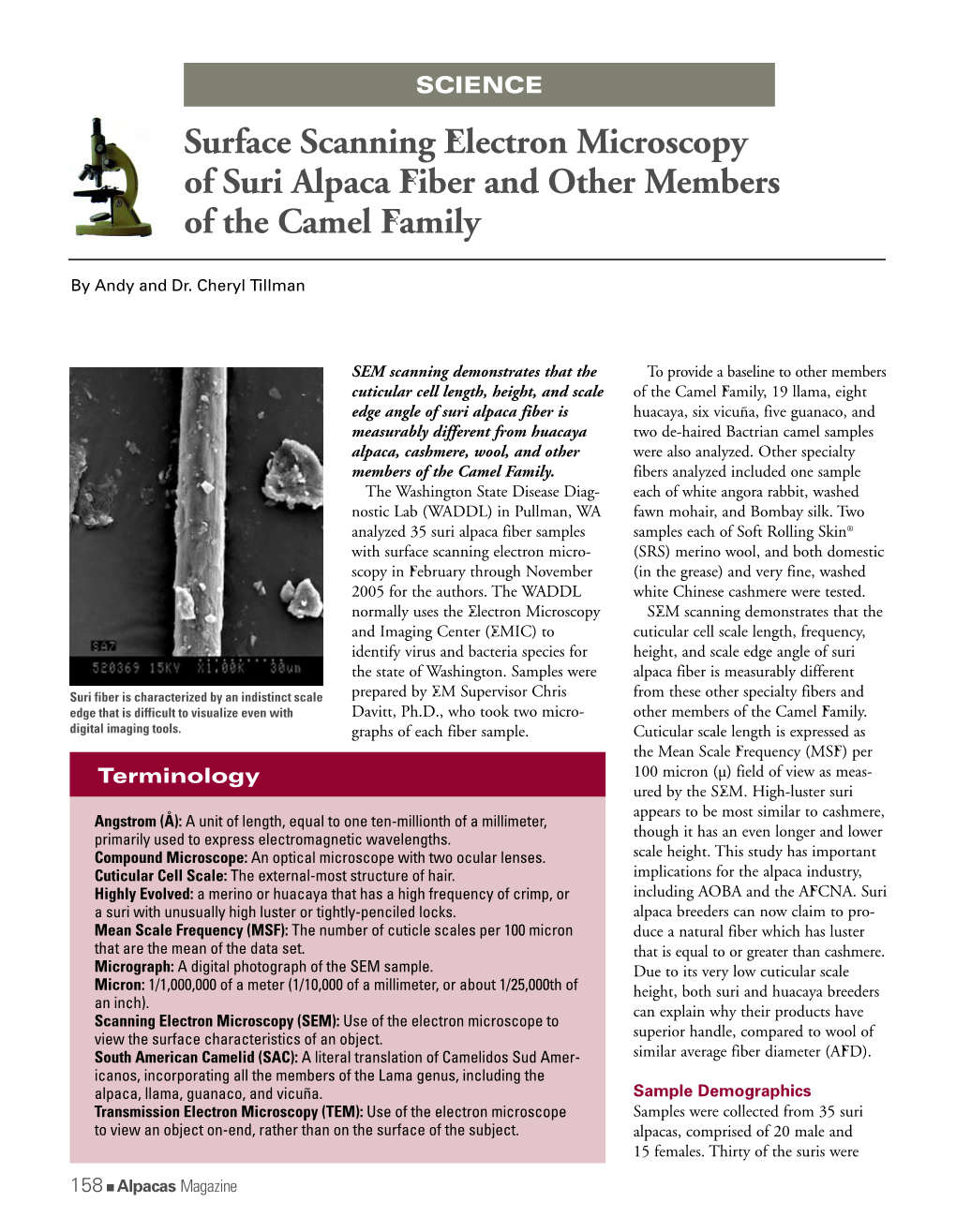 Surface Scanning Electron Microscopy of Suri Alpaca Fiber and Other Members of the Camel Family