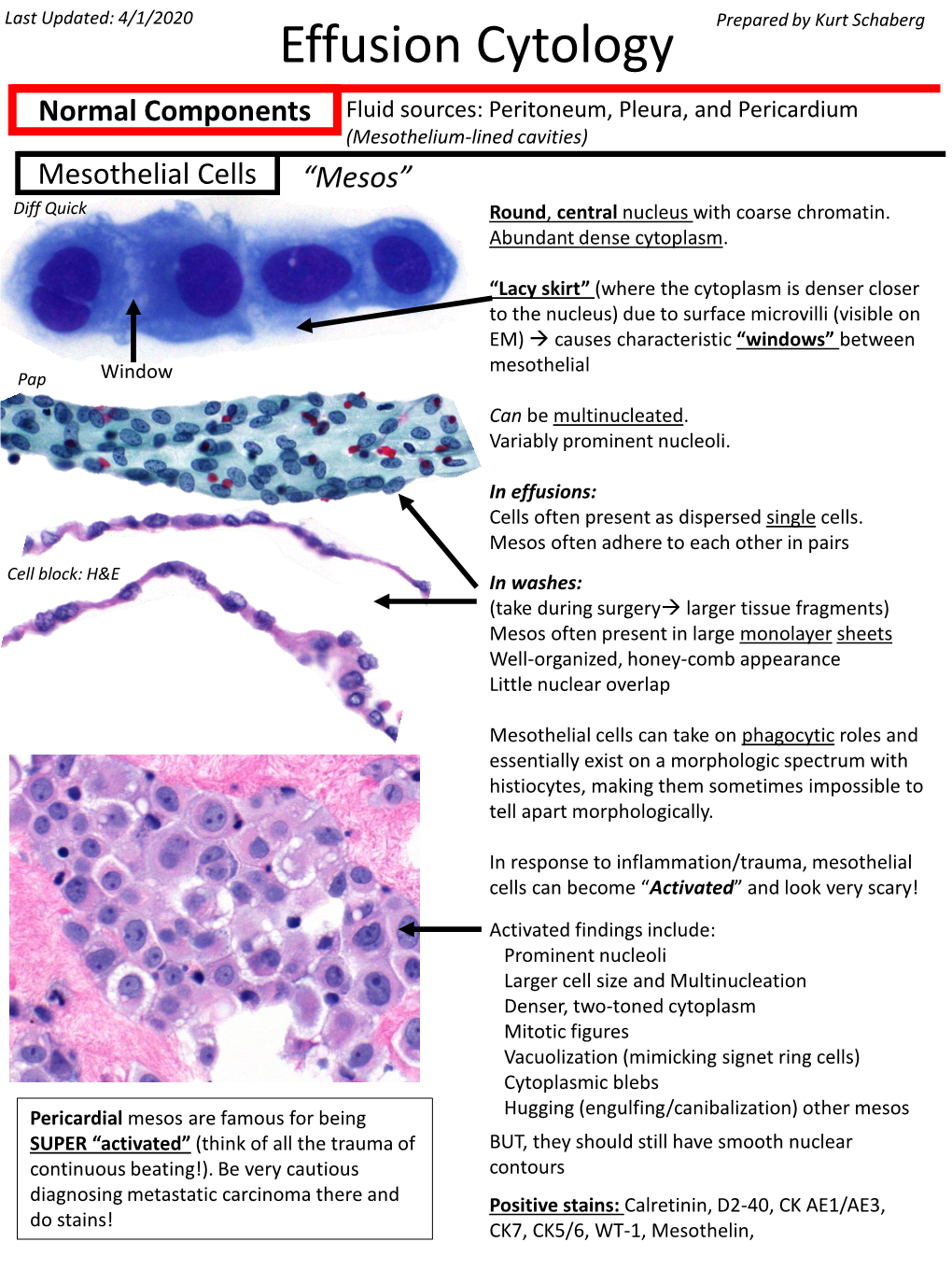 Effusion Cytology