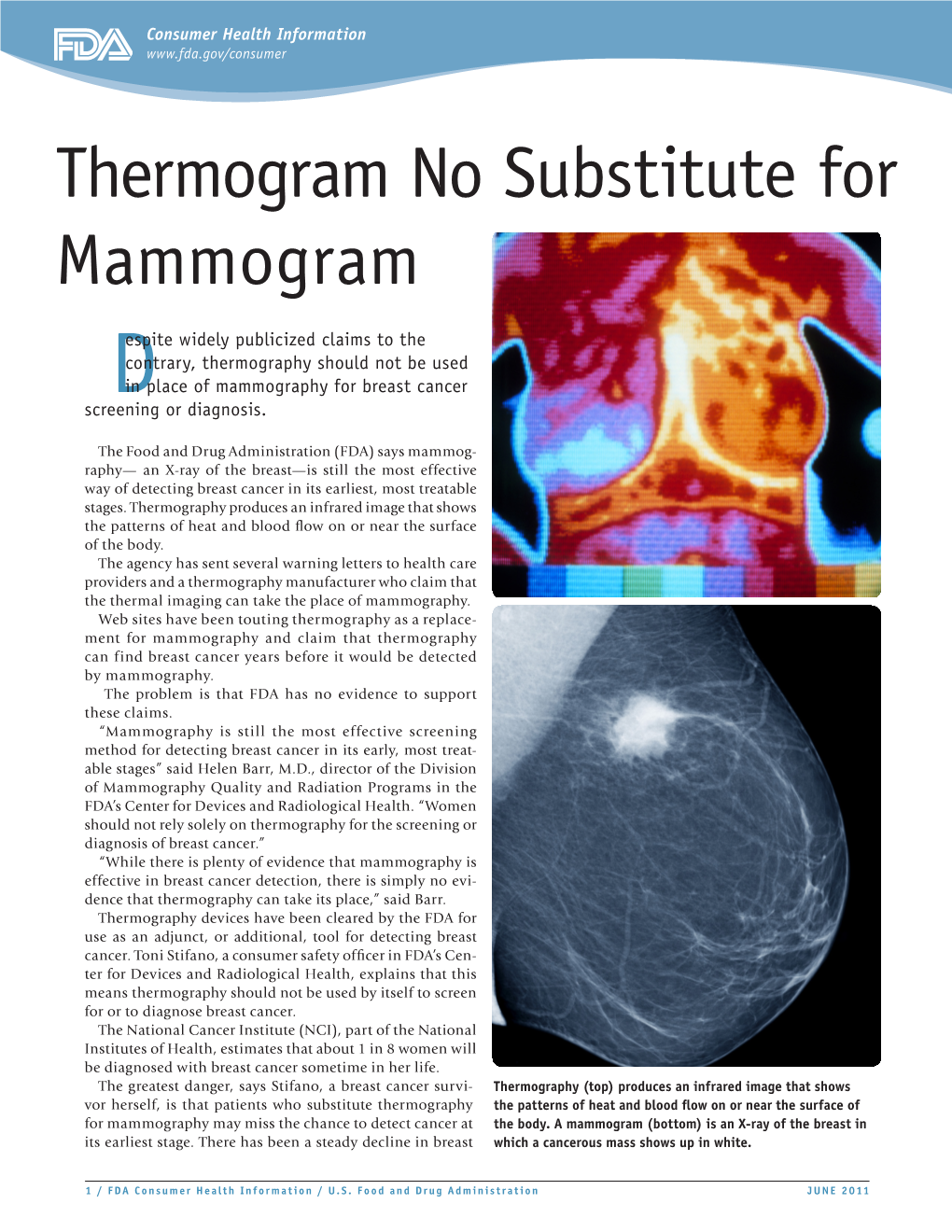 Thermogram No Substitute for Mammogram