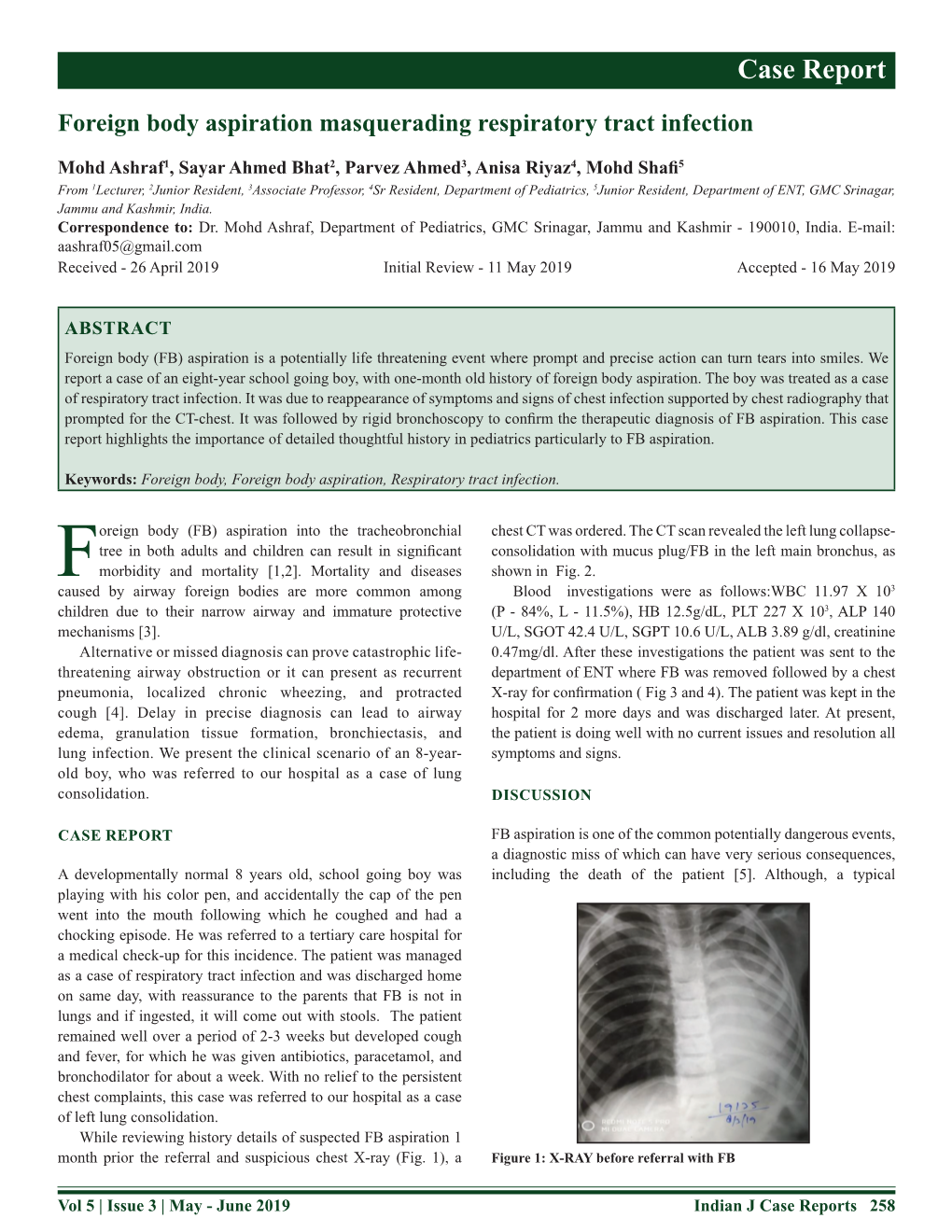 Foreign Body Aspiration Masquerading Respiratory Tract Infection