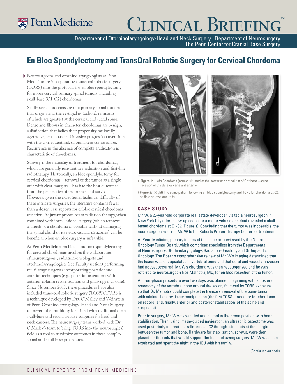 Clinical Briefingtm Department of Otorhinolaryngology-Head and Neck Surgery | Department of Neurosurgery the Penn Center for Cranial Base Surgery