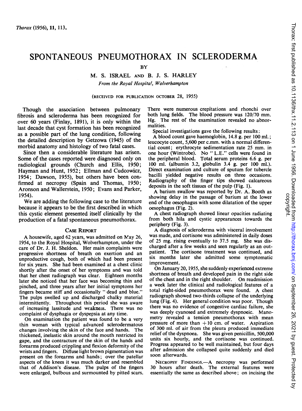 Spontaneous Pneumothorax in Scleroderma by M