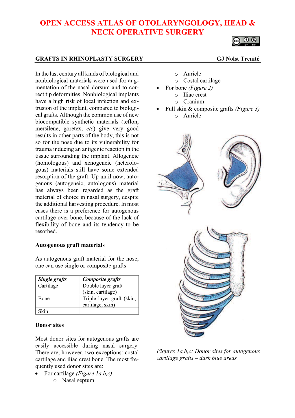 GRAFTS in RHINOPLASTY SURGERY GJ Nolst Trenité