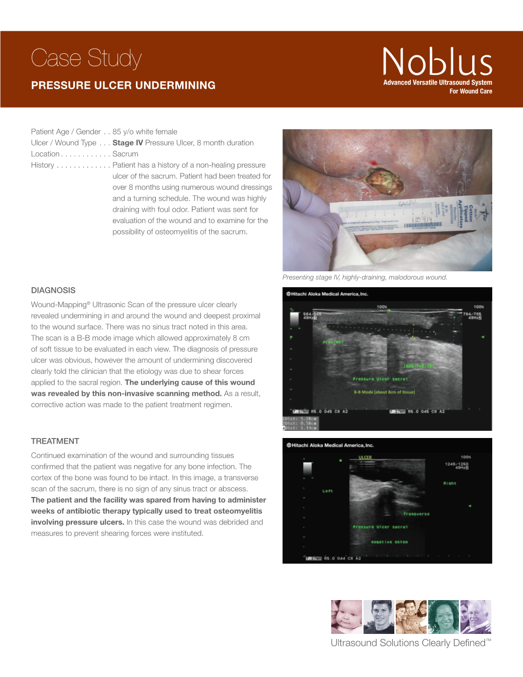 Noblus-Wound-Mapping-Case-Study