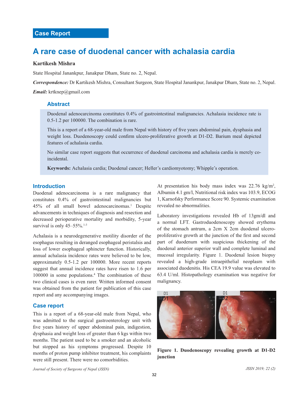 A Rare Case of Duodenal Cancer with Achalasia Cardia Kartikesh Mishra State Hospital Janankpur, Janakpur Dham, State No