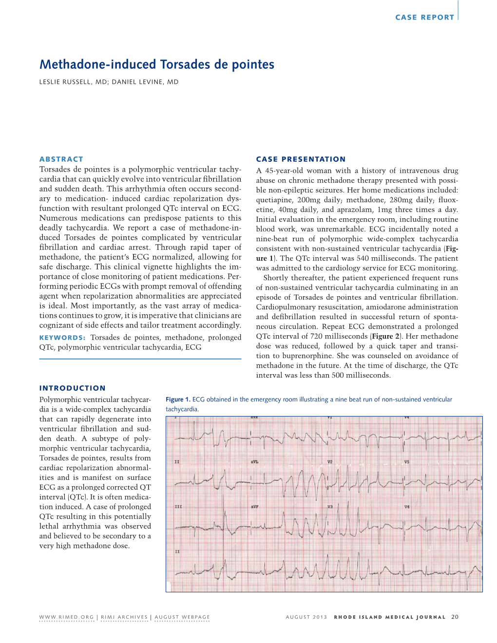 Methadone-Induced Torsades De Pointes