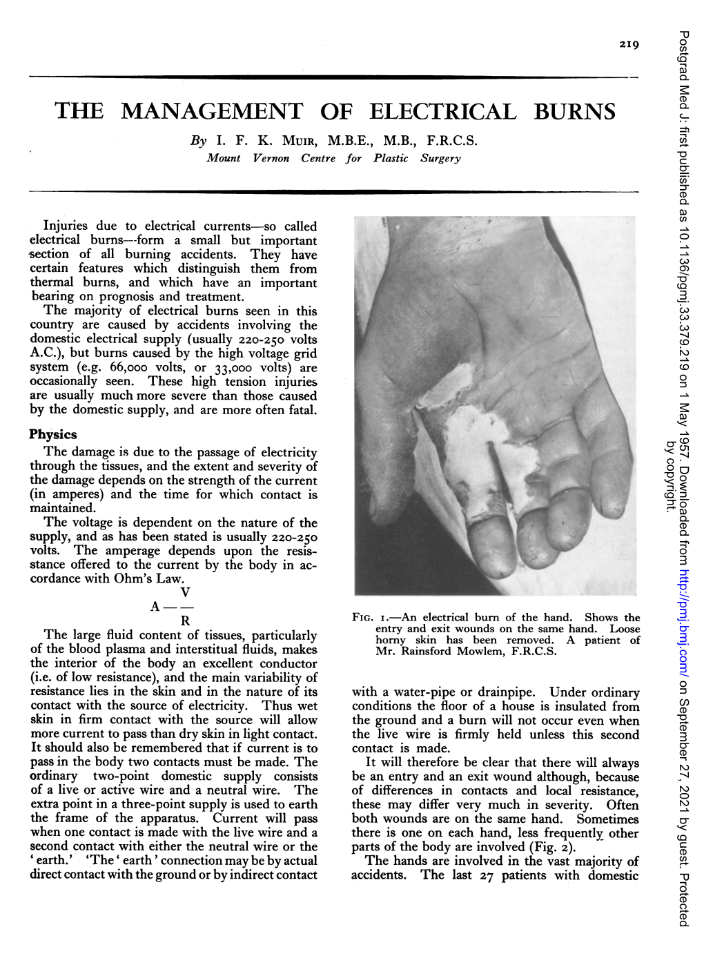 THE MANAGEMENT of ELECTRICAL BURNS by I