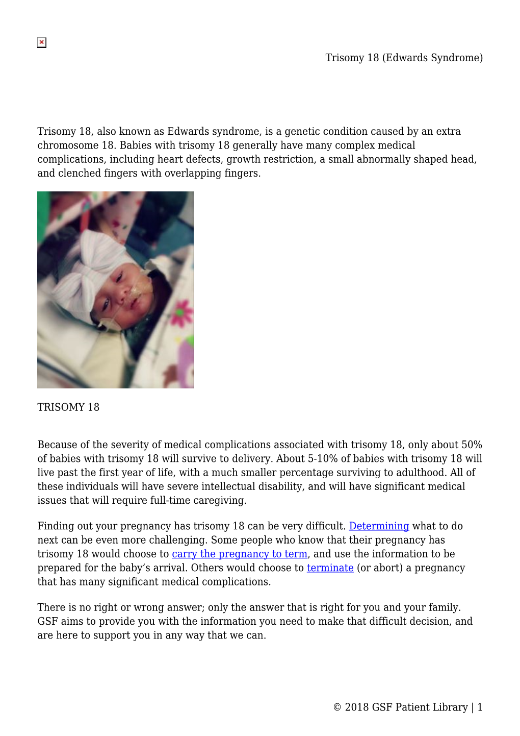 Trisomy 18 (Edwards Syndrome)