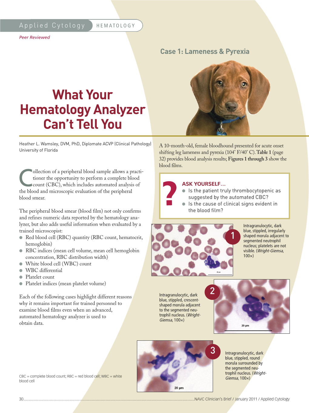 What Your Hematology Analyzer Can't Tell
