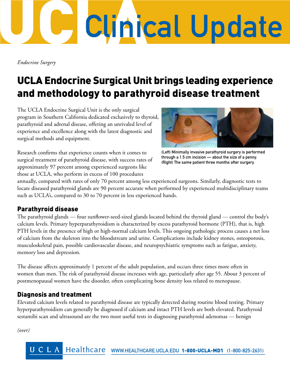 Parathyroid Disease Treatment