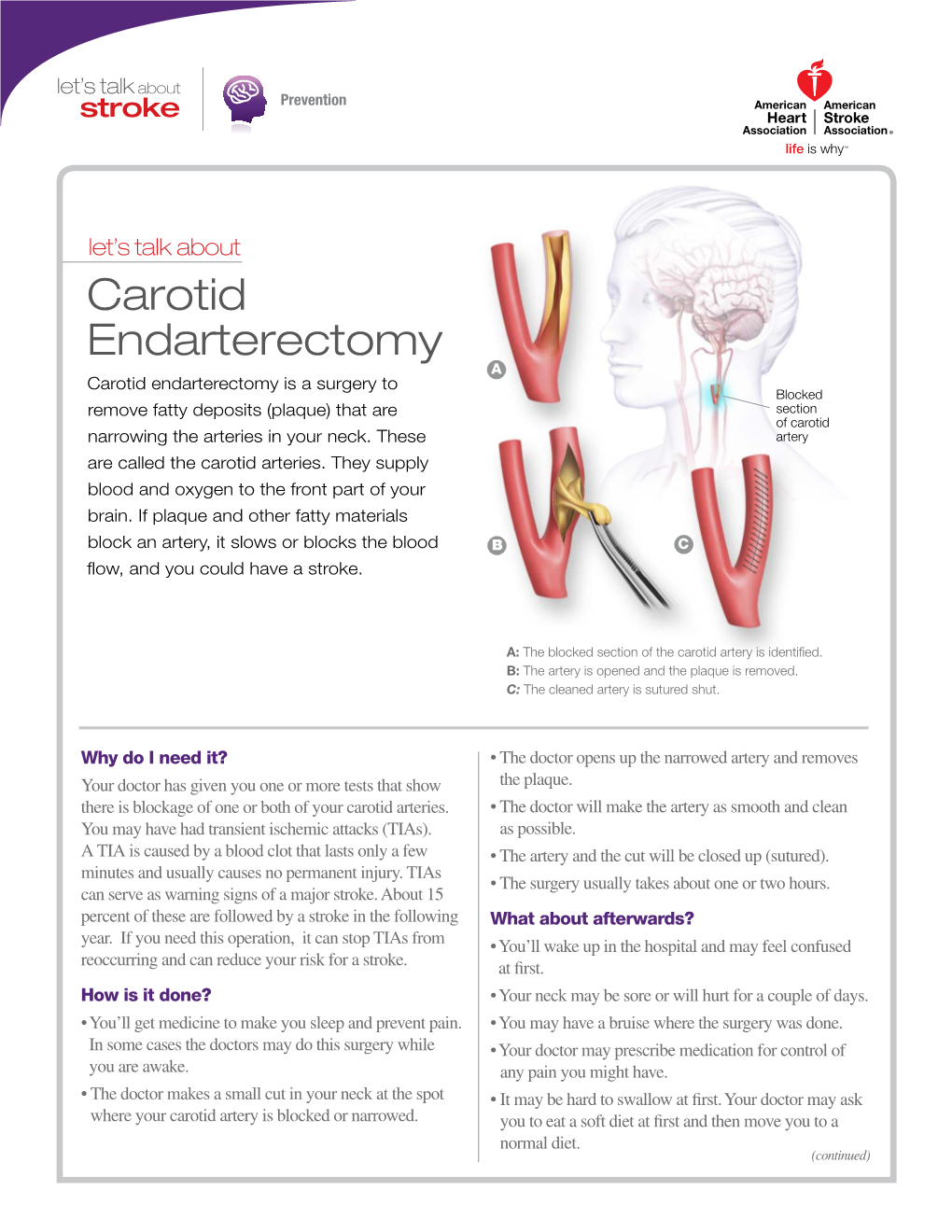 Let's Talk About Carotid Endarterectomy