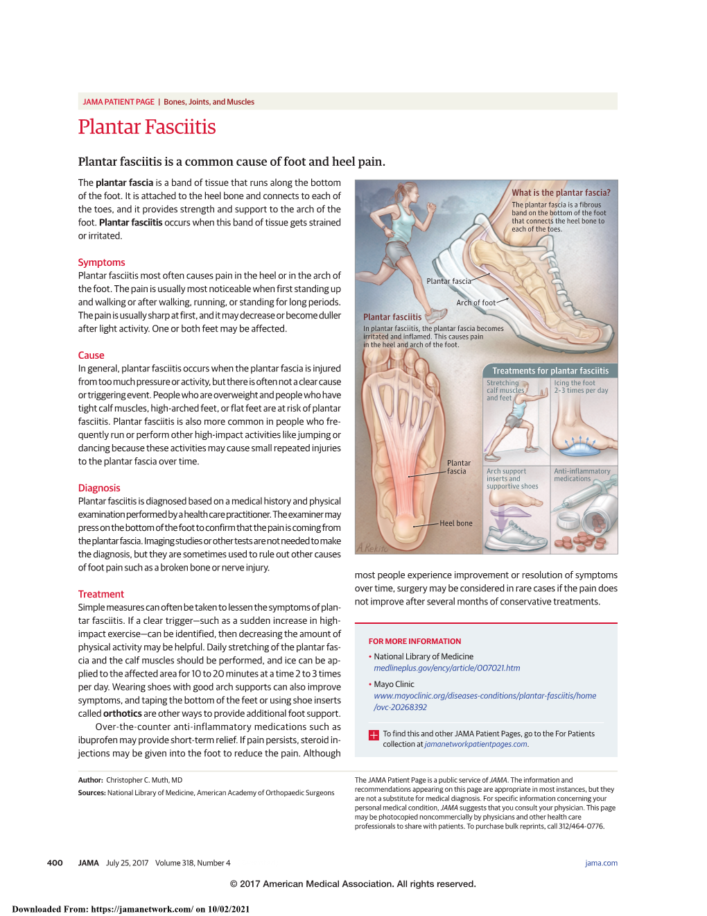 Plantar Fasciitis