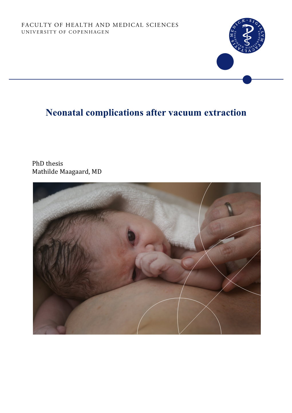 Neonatal Complications After Vacuum Extraction