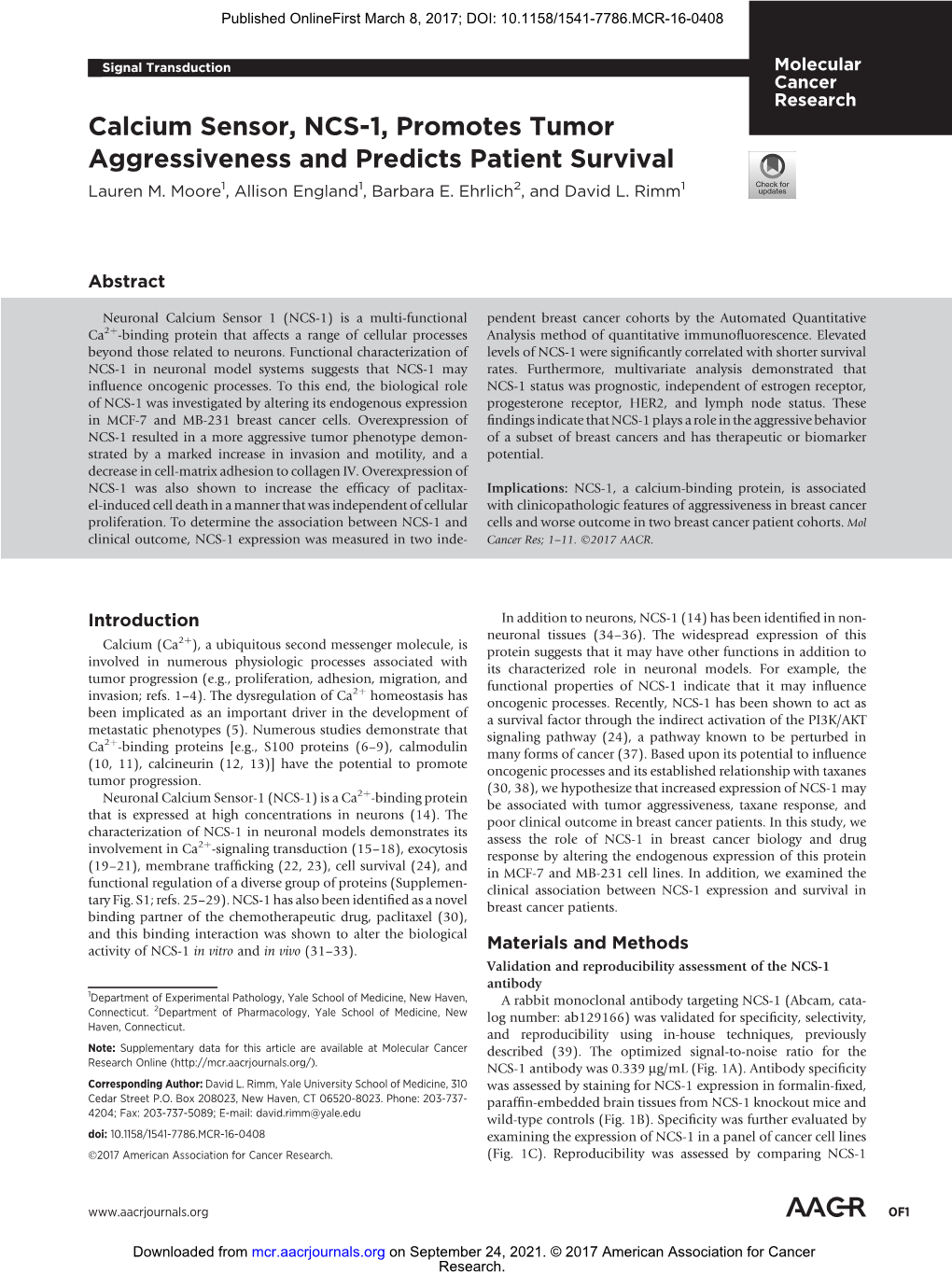 Calcium Sensor, NCS-1, Promotes Tumor Aggressiveness and Predicts Patient Survival Lauren M