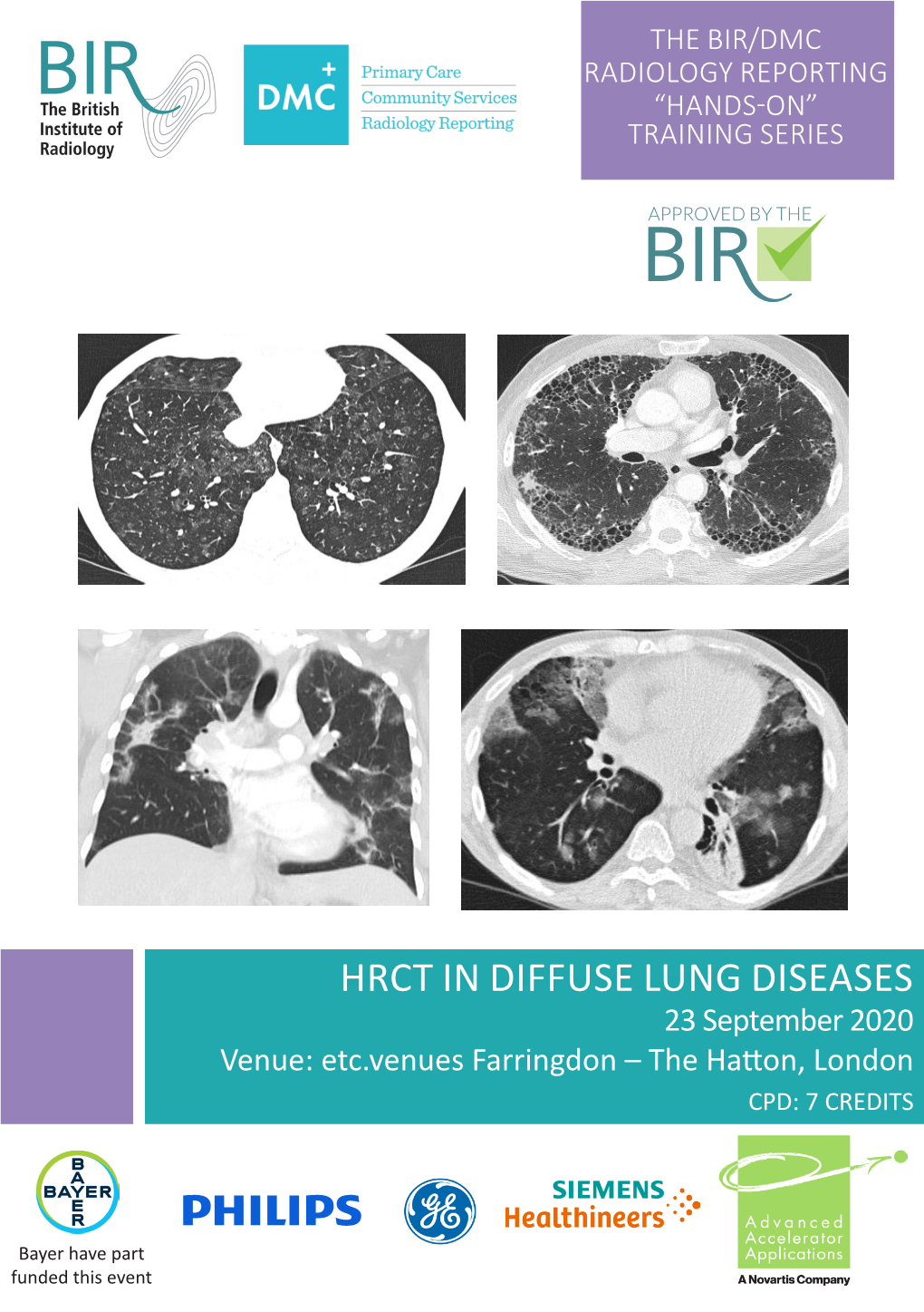 HRCT in DIFFUSE LUNG DISEASES 23 September 2020 Venue: Etc.Venues Farringdon – the Hatton, London CPD: 7 CREDITS