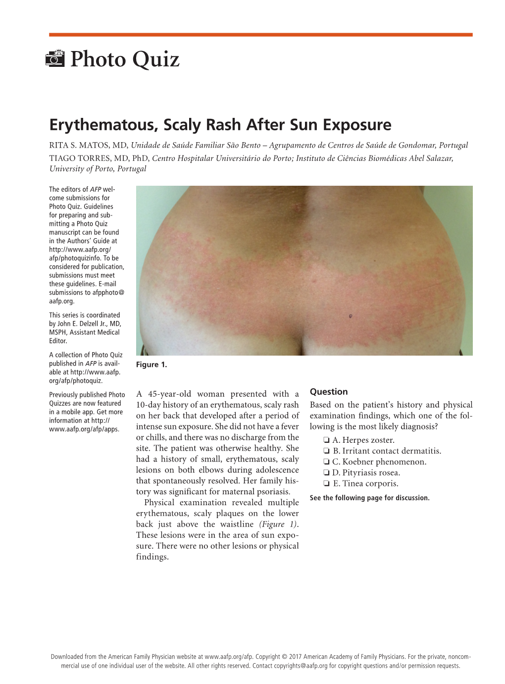Erythematous, Scaly Rash After Sun Exposure RITA S