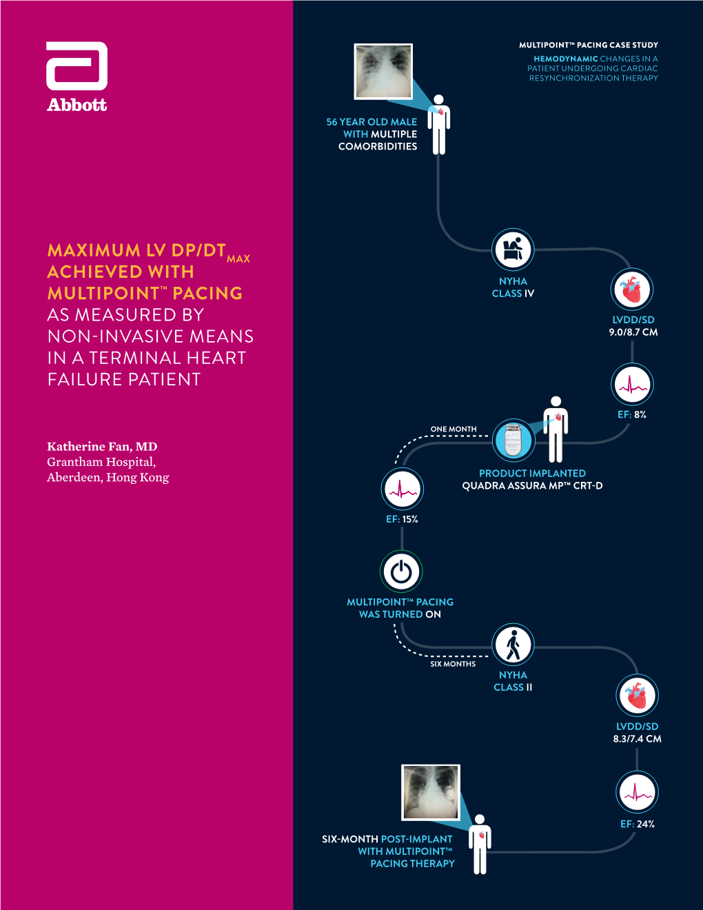 Maximum Lv Dp/Dt Achieved with Multipoint™ Pacing As