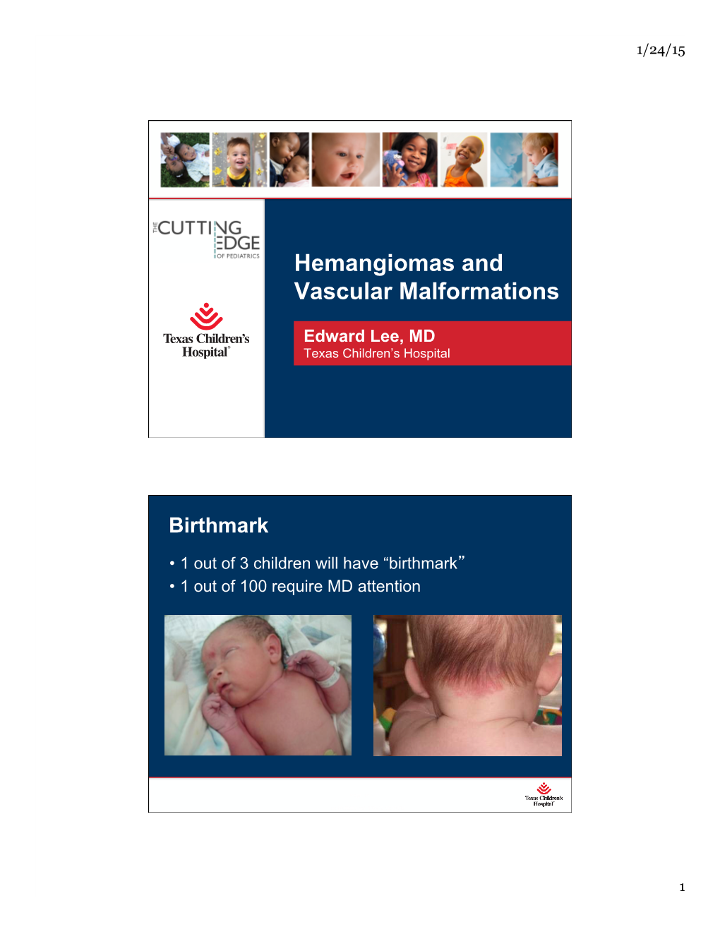 Hemangiomas and Vascular Malformations