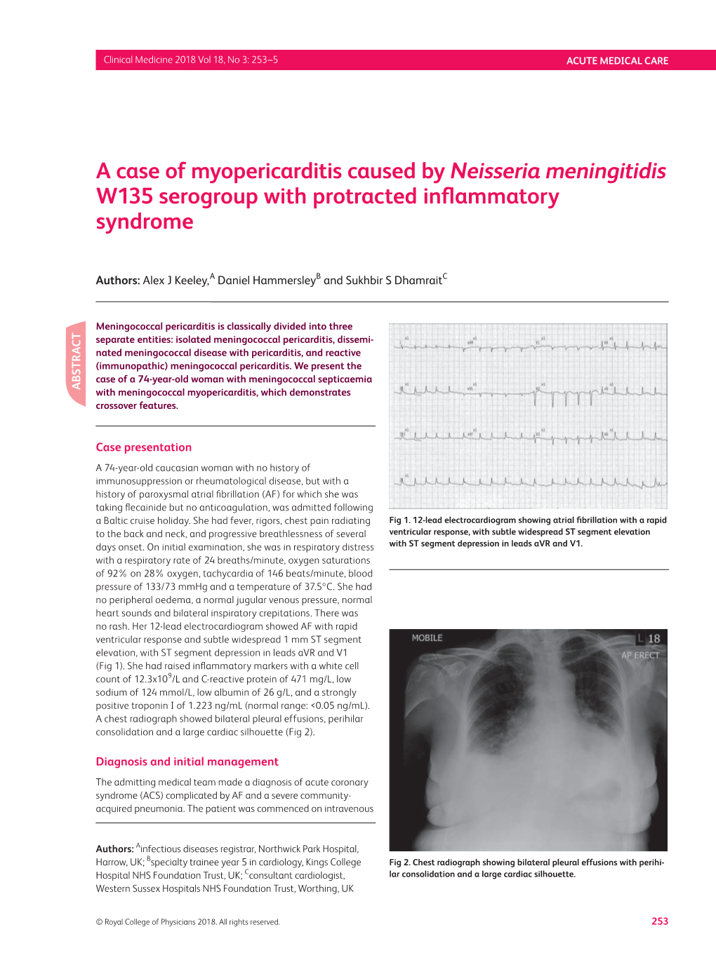 A Case of Myopericarditis Caused by Neisseria Meningitidis W135
