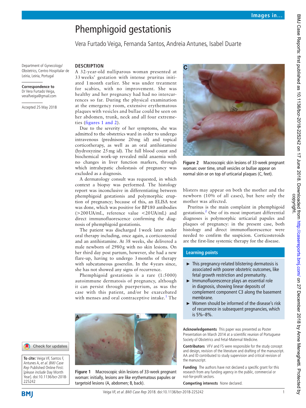 Phemphigoid Gestationis Vera Furtado Veiga, Fernanda Santos, Andreia Antunes, Isabel Duarte