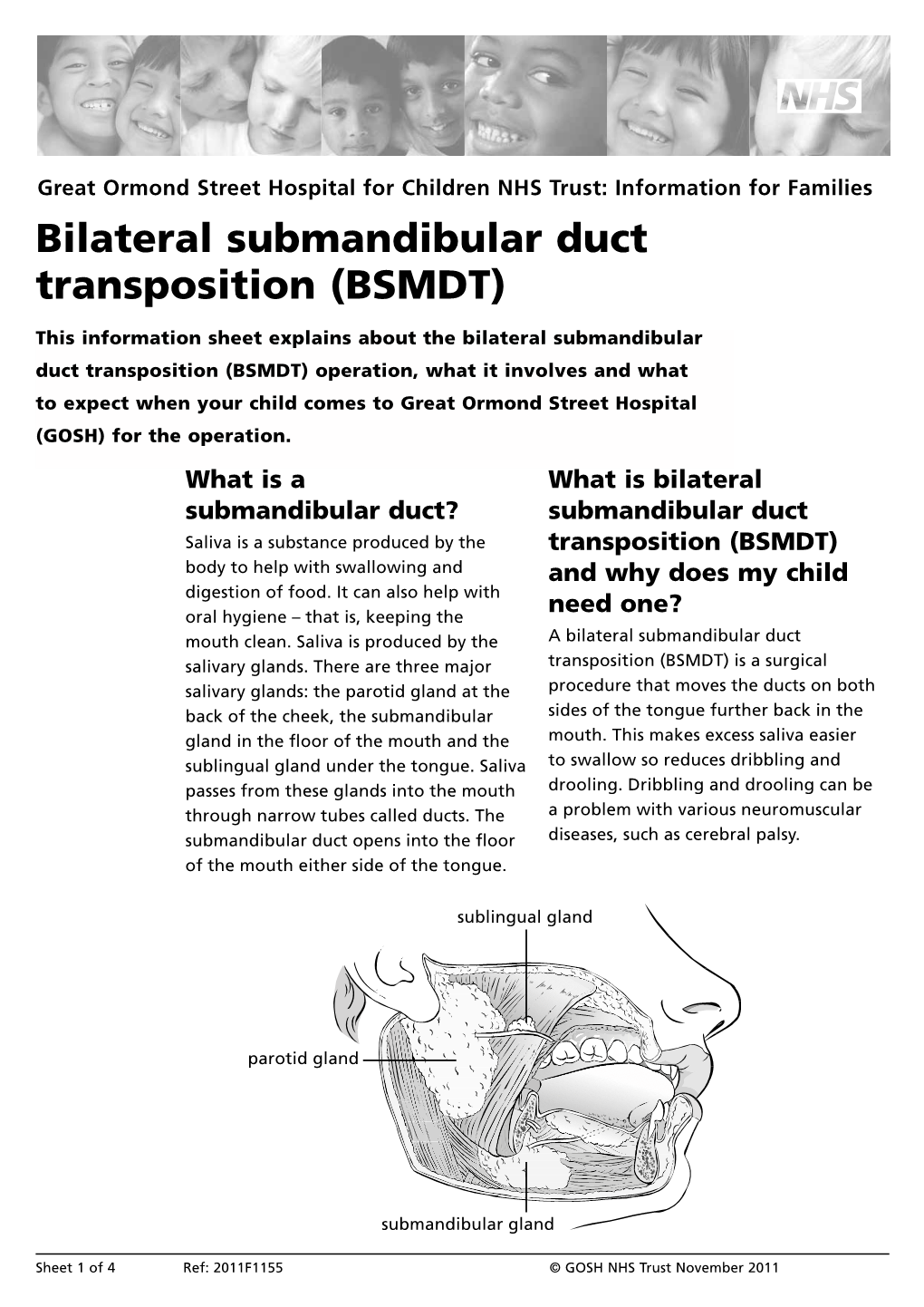 Download Bilateral Submandibular Duct Transposition (BSMDT)