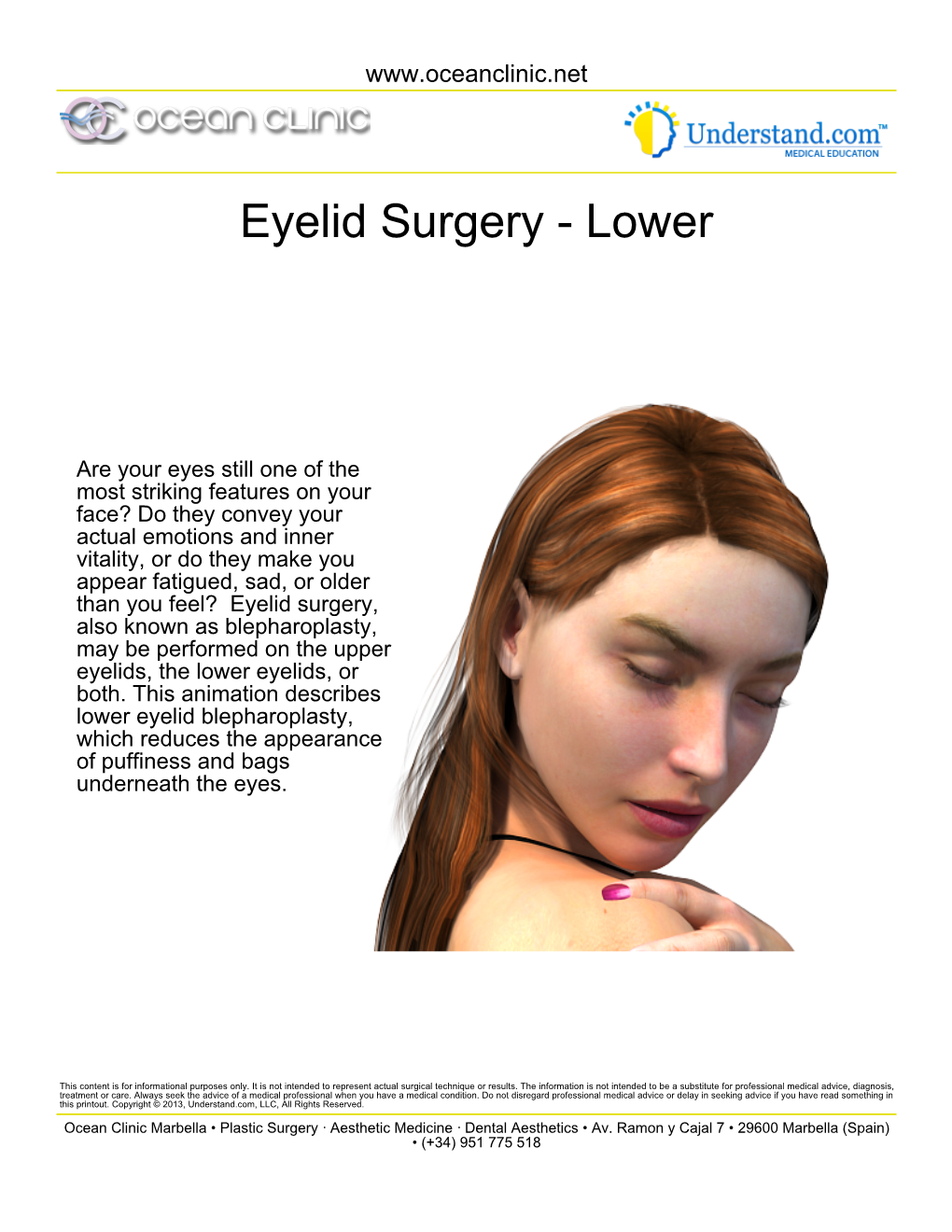 Eyelid Surgery - Lower