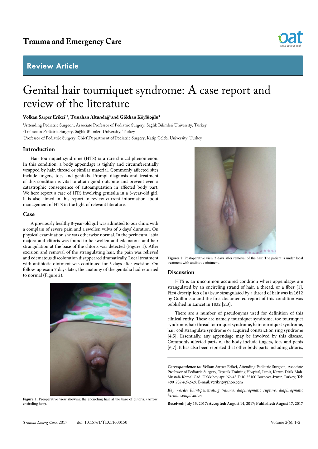 Genital Hair Tourniquet Syndrome