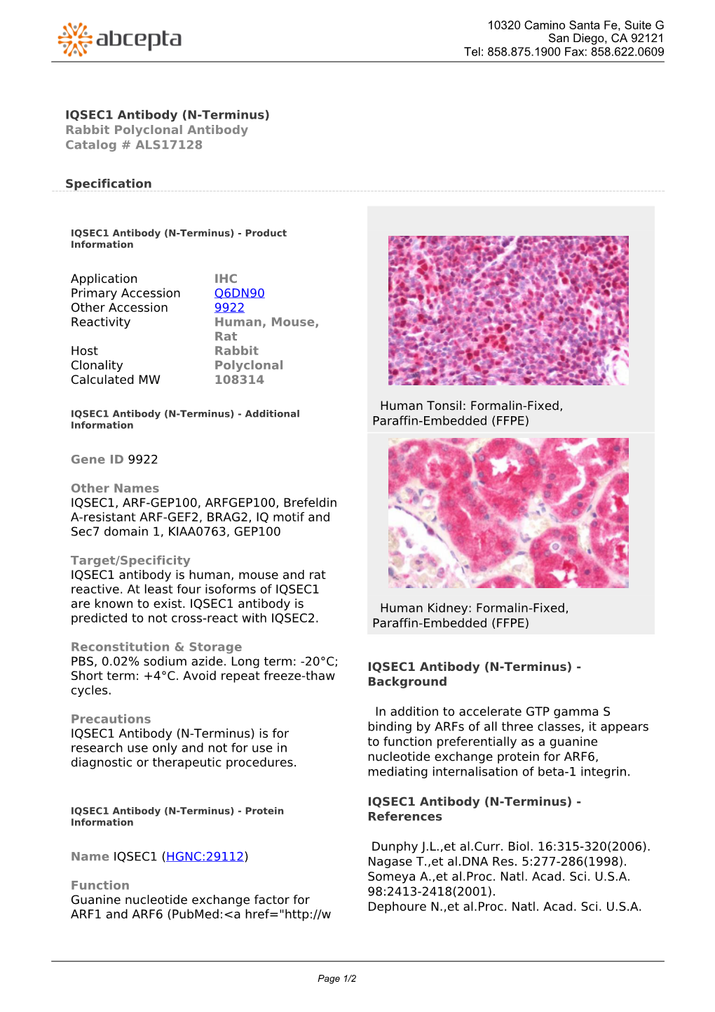IQSEC1 Antibody (N-Terminus) Rabbit Polyclonal Antibody Catalog # ALS17128