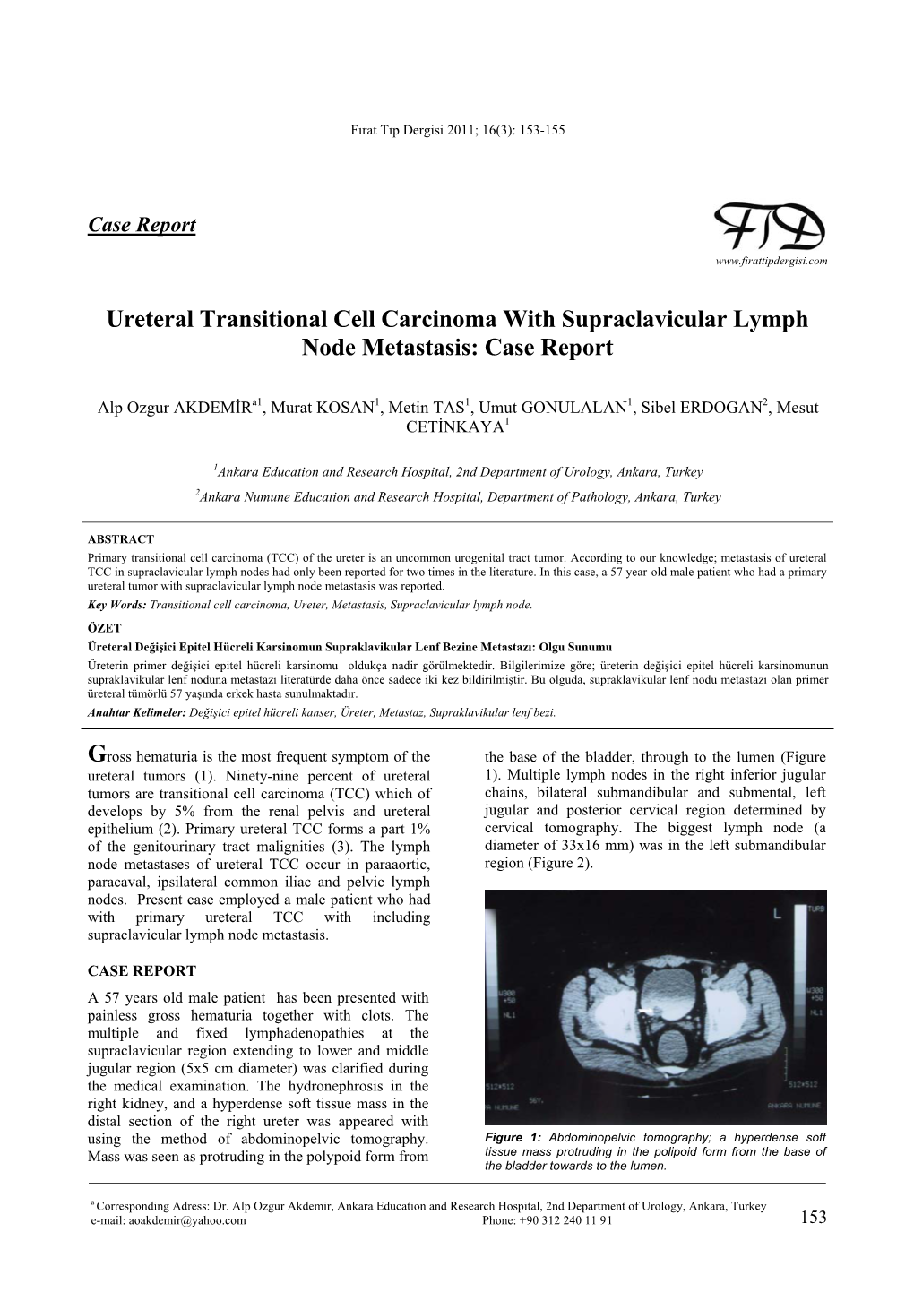 Ureteral Transitional Cell Carcinoma with Supraclavicular Lymph Node Metastasis: Case Report