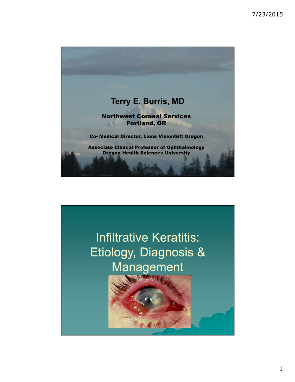 Infiltrative Keratitis: Etiology, Diagnosis & Management
