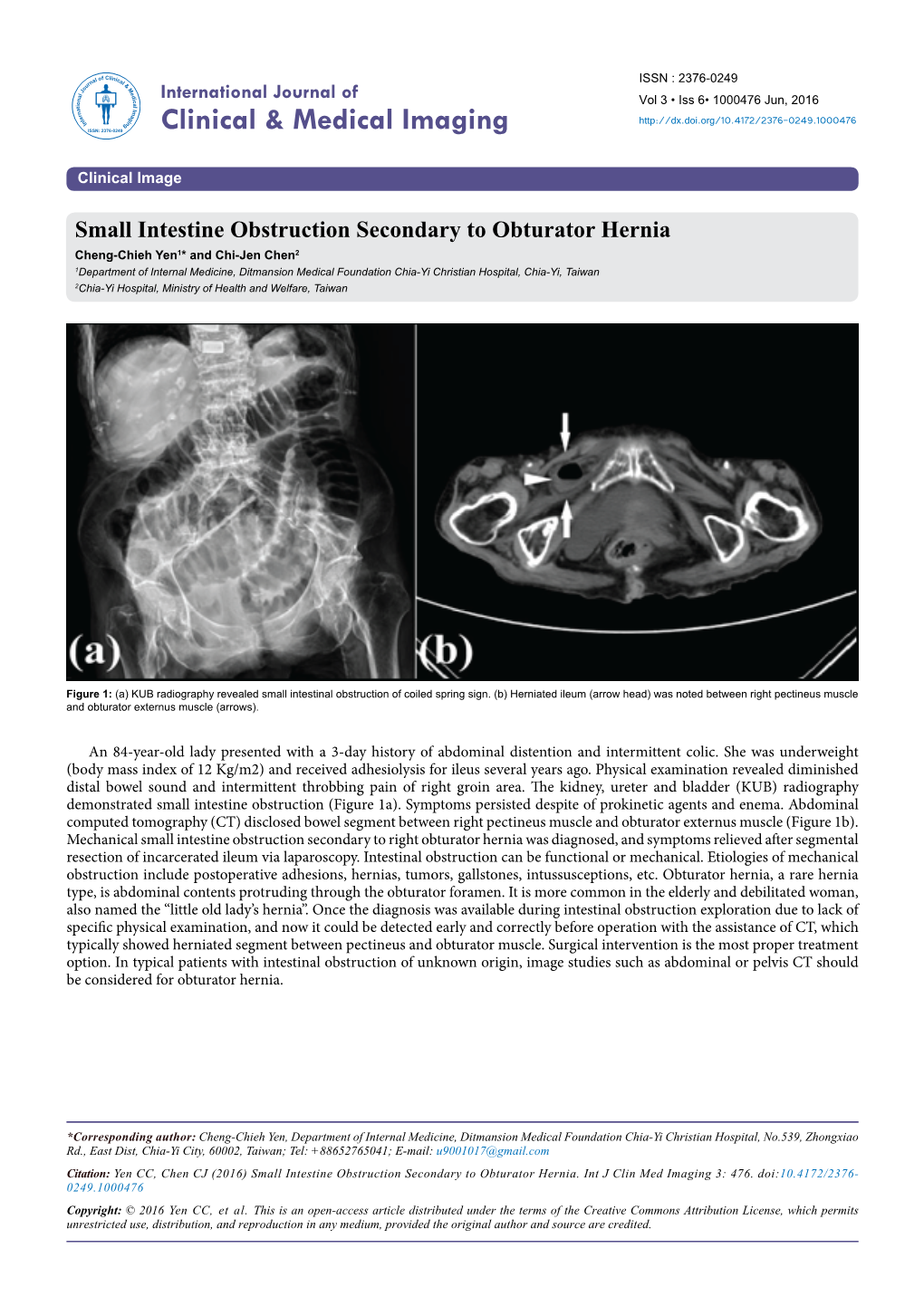 Small Intestine Obstruction Secondary to Obturator Hernia