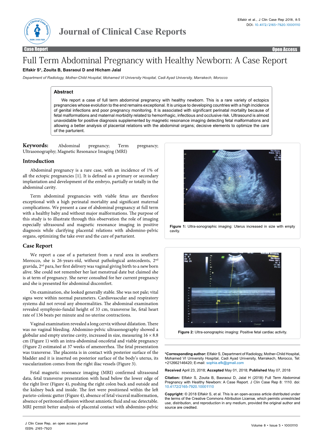 Full Term Abdominal Pregnancy with Healthy Newborn