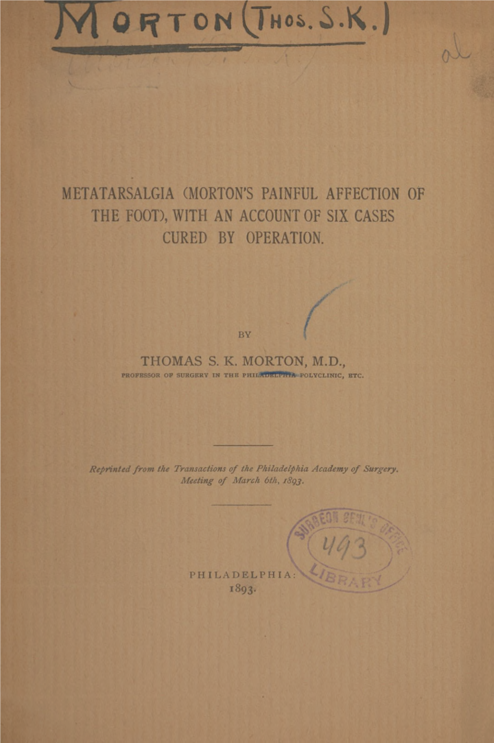 Metatarsalgia (Morton's Painful Affection of the Foot), with an Account of Six Cases Cured by Operation