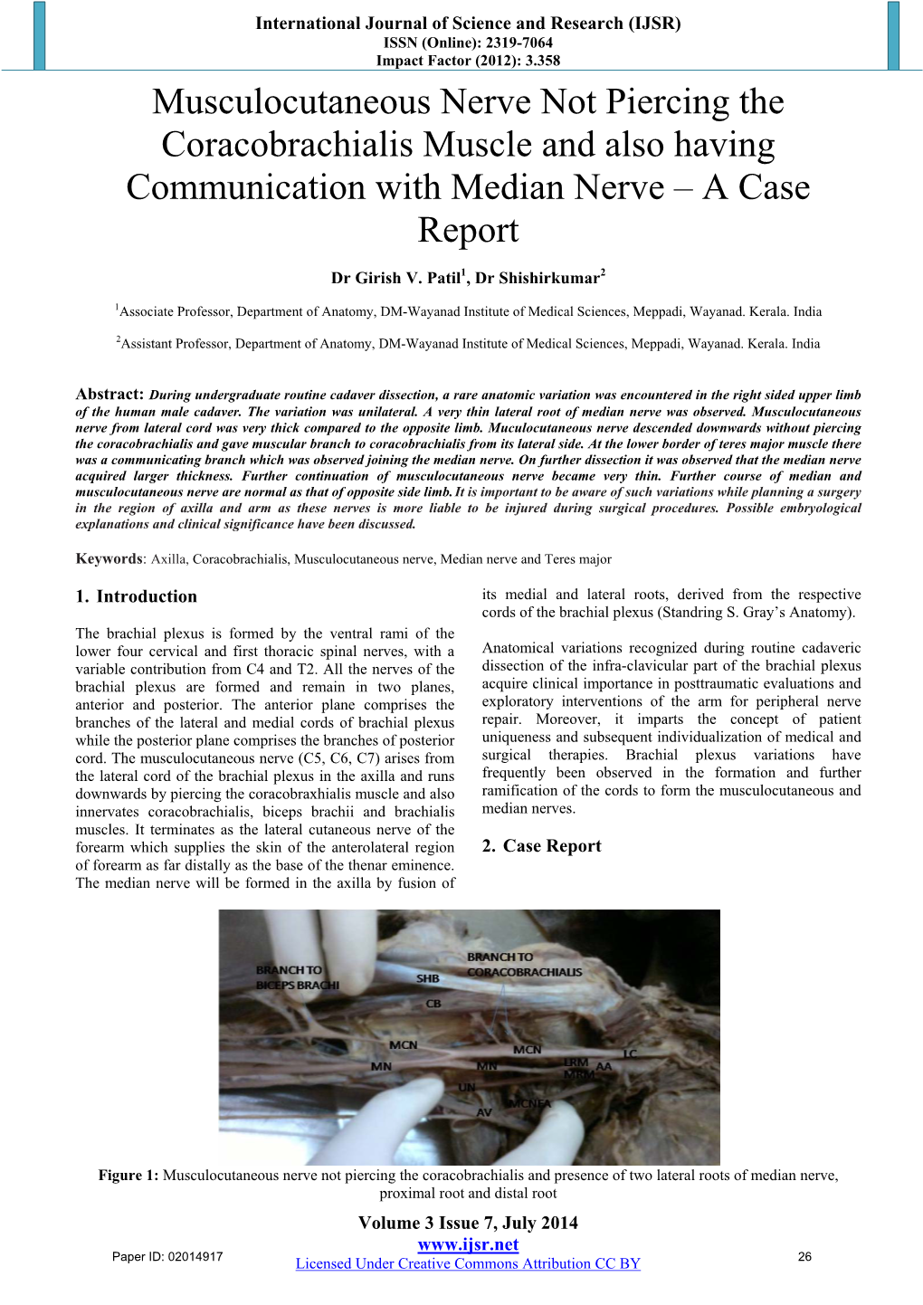 Musculocutaneous Nerve Not Piercing the Coracobrachialis Muscle and Also Having Communication with Median Nerve – a Case Report