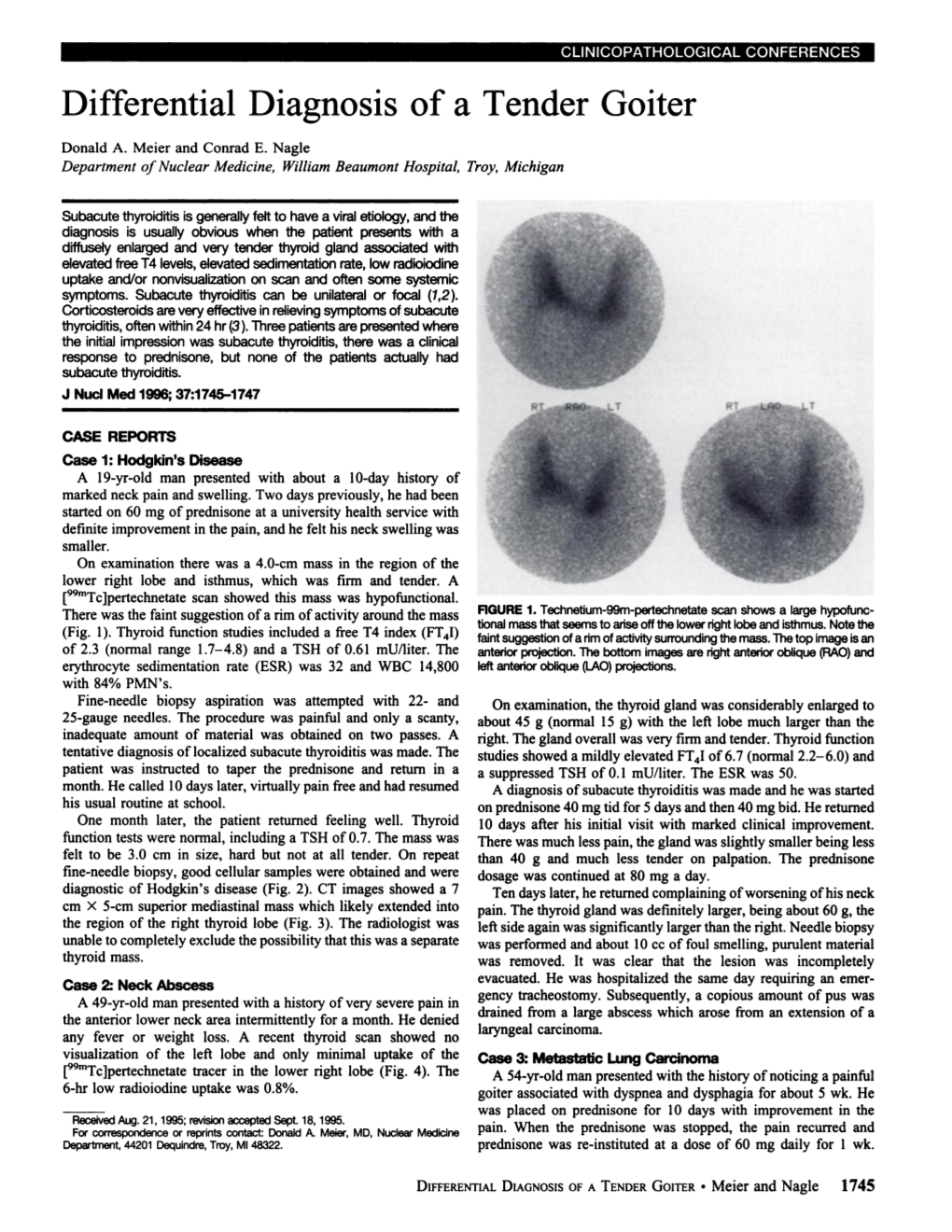 Differential Diagnosis of a Tender Goiter