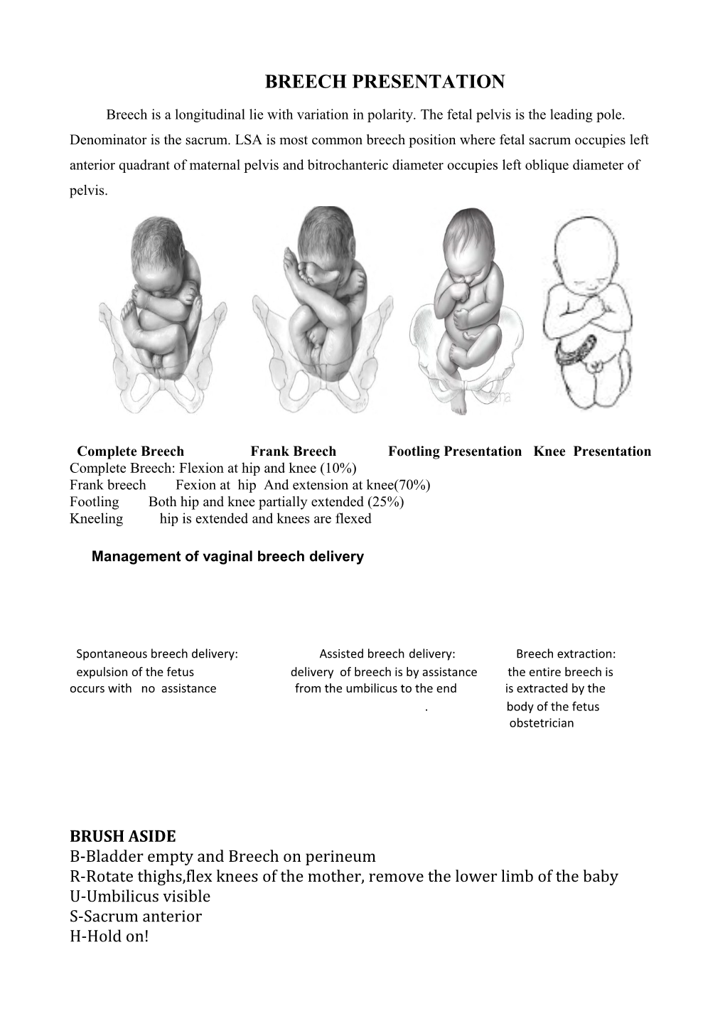 Breech Presentation