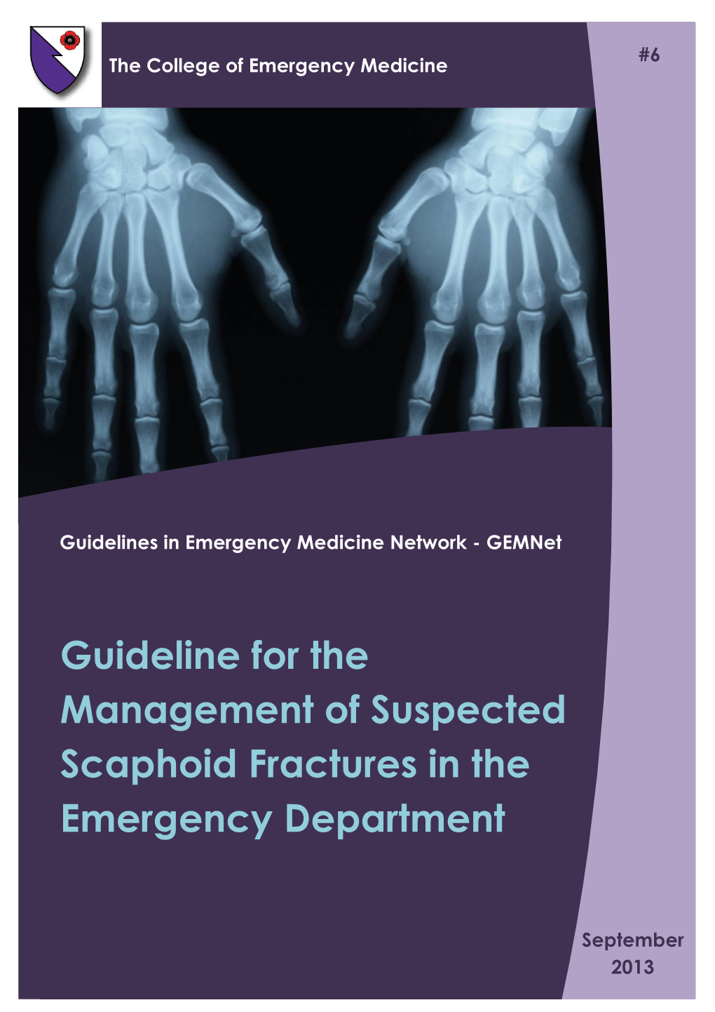 Suspected Scaphoid Fractures in the Emergency Department