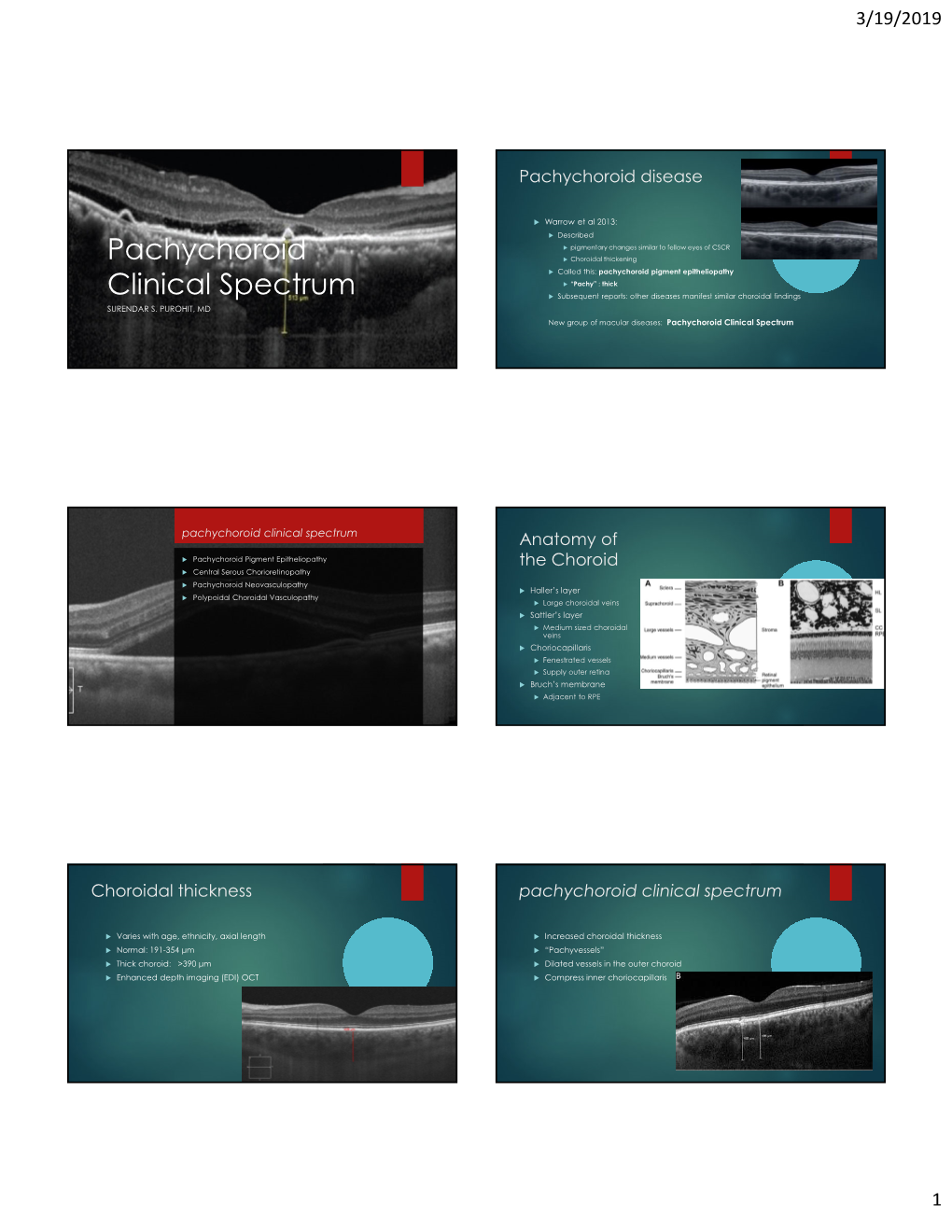 Central Serous Chorioretinopathy