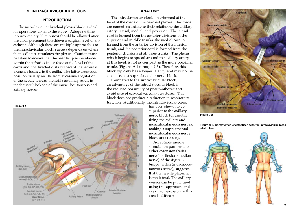 INFRACLAVICULAR BLOCK ANATOMY the Infraclavicular Block Is Performed at the INTRODUCTION Level of the Cords of the Brachial Plexus