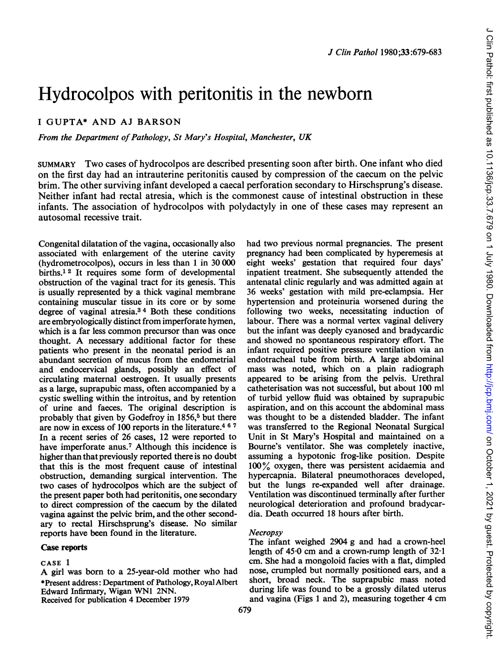 Hydrocolpos with Peritonitis Inthe Newborn