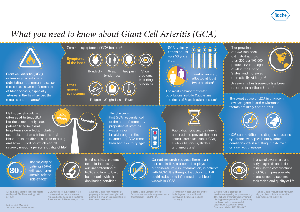 What You Need to Know About Giant Cell Arteritis Facts On