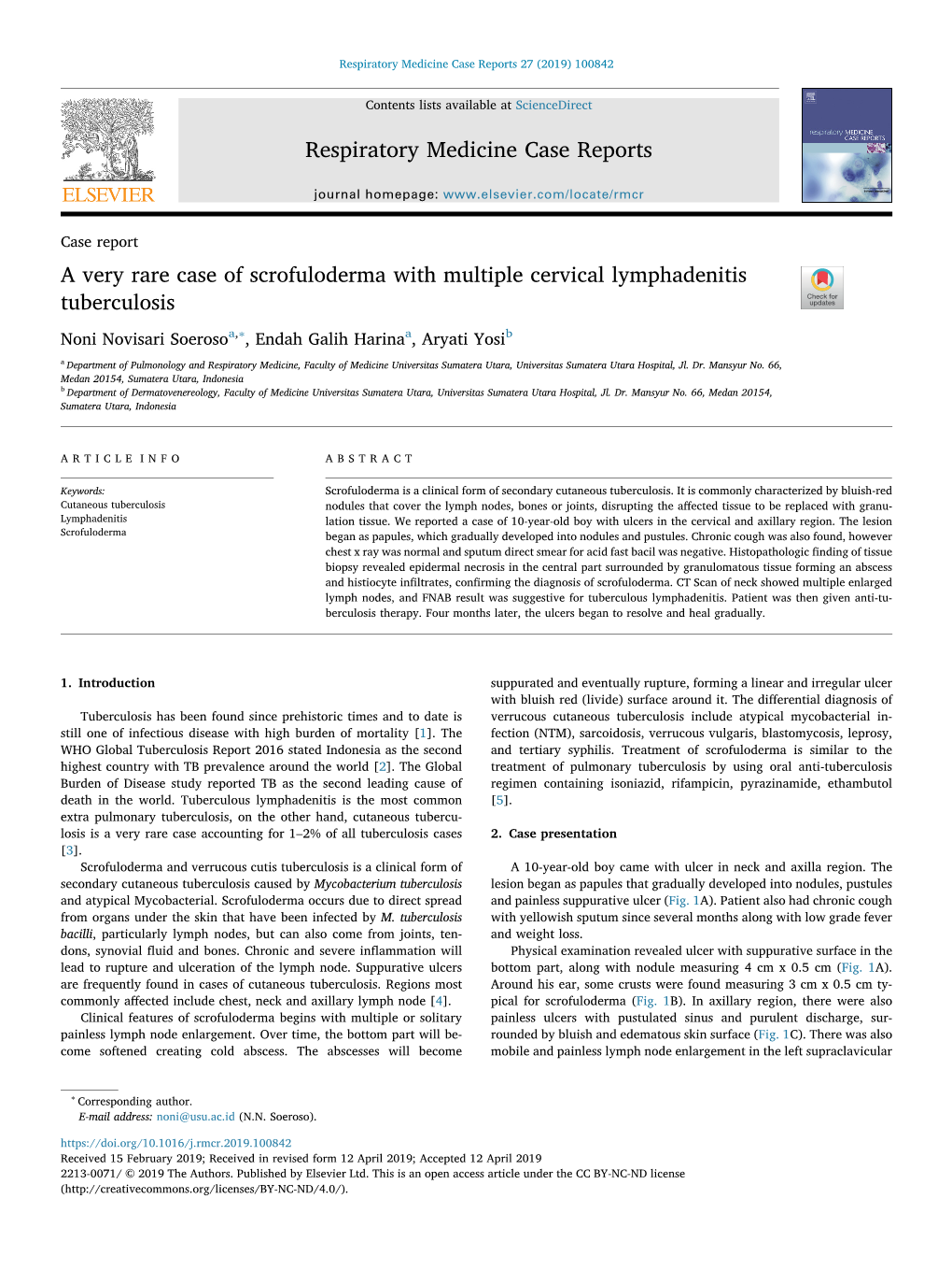 A Very Rare Case of Scrofuloderma with Multiple Cervical Lymphadenitis Tuberculosis T