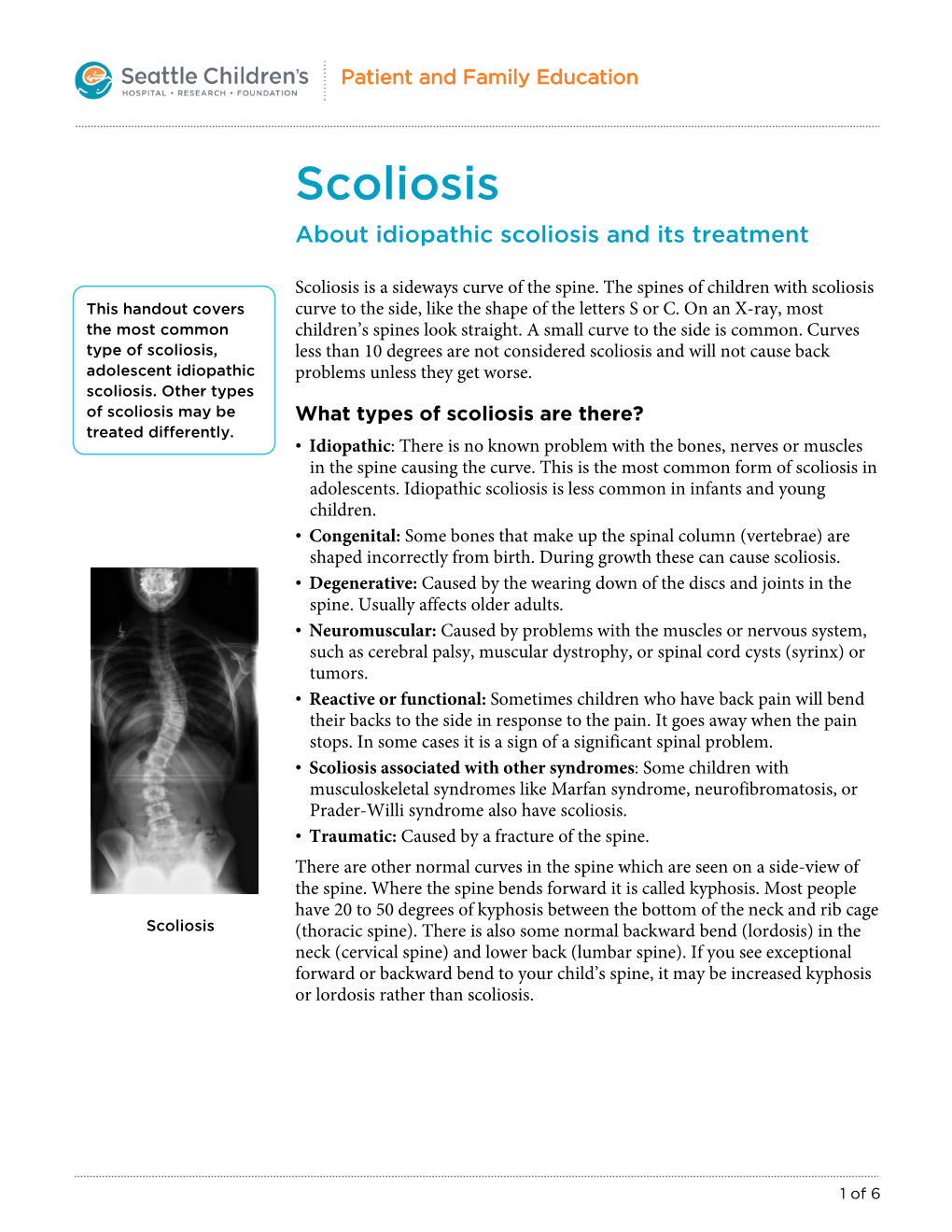 About Idiopathic Scoliosis and Its Treatment