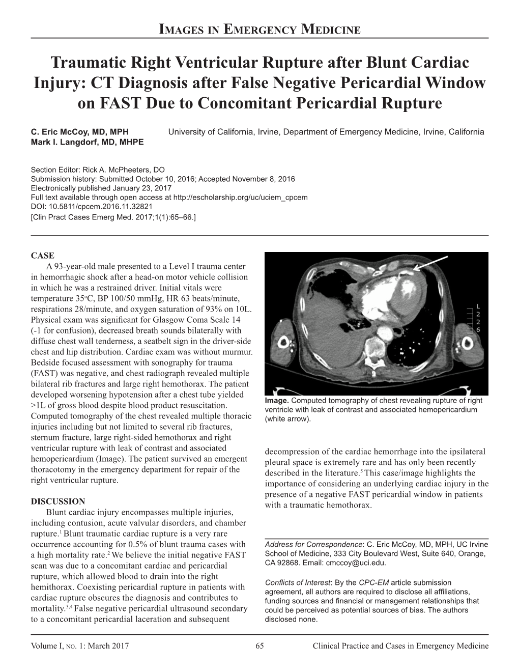 Traumatic Right Ventricular Rupture After Blunt Cardiac Injury: CT Diagnosis After False Negative Pericardial Window on FAST Due to Concomitant Pericardial Rupture