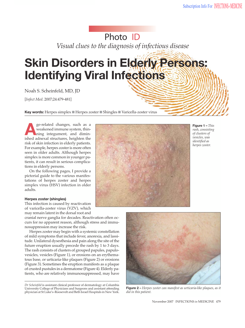 Skin Disorders in Elderly Persons: Identifying Viral Infections