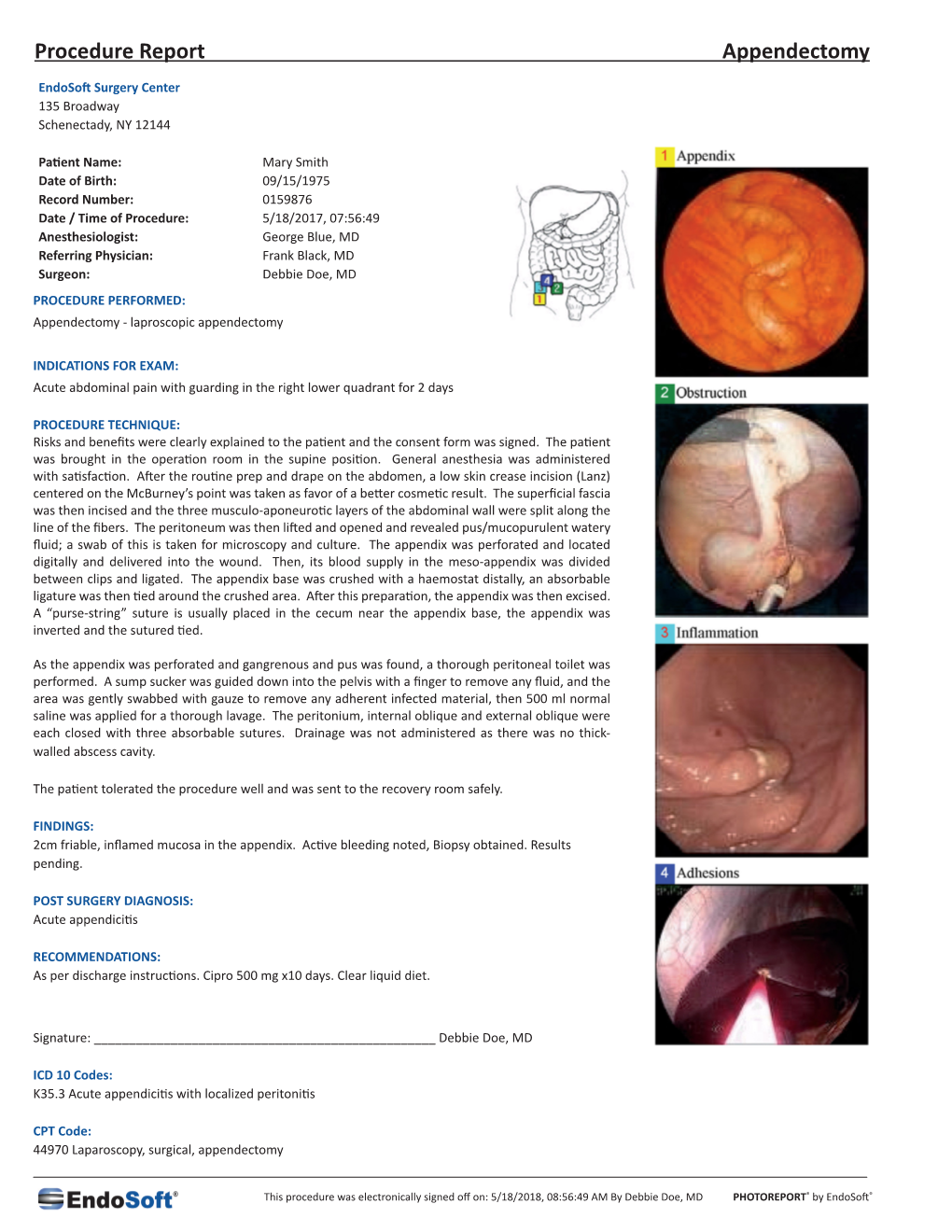 Procedure Report Appendectomy