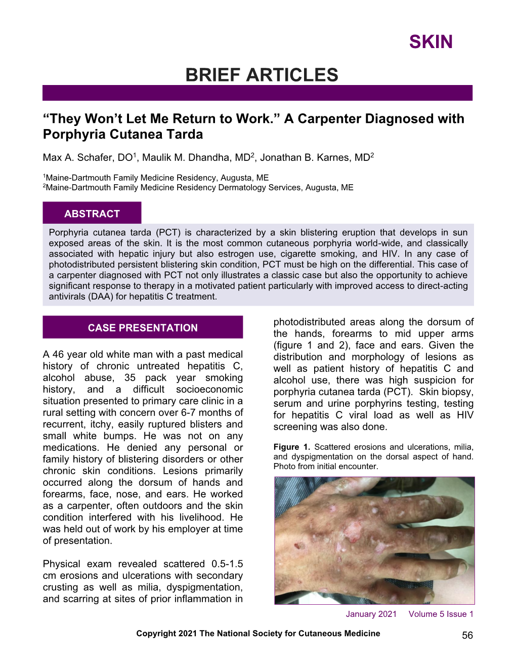 A Carpenter Diagnosed with Porphyria Cutanea Tarda